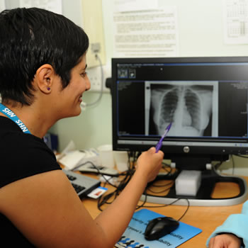 Doctor looking at a chest x-ray